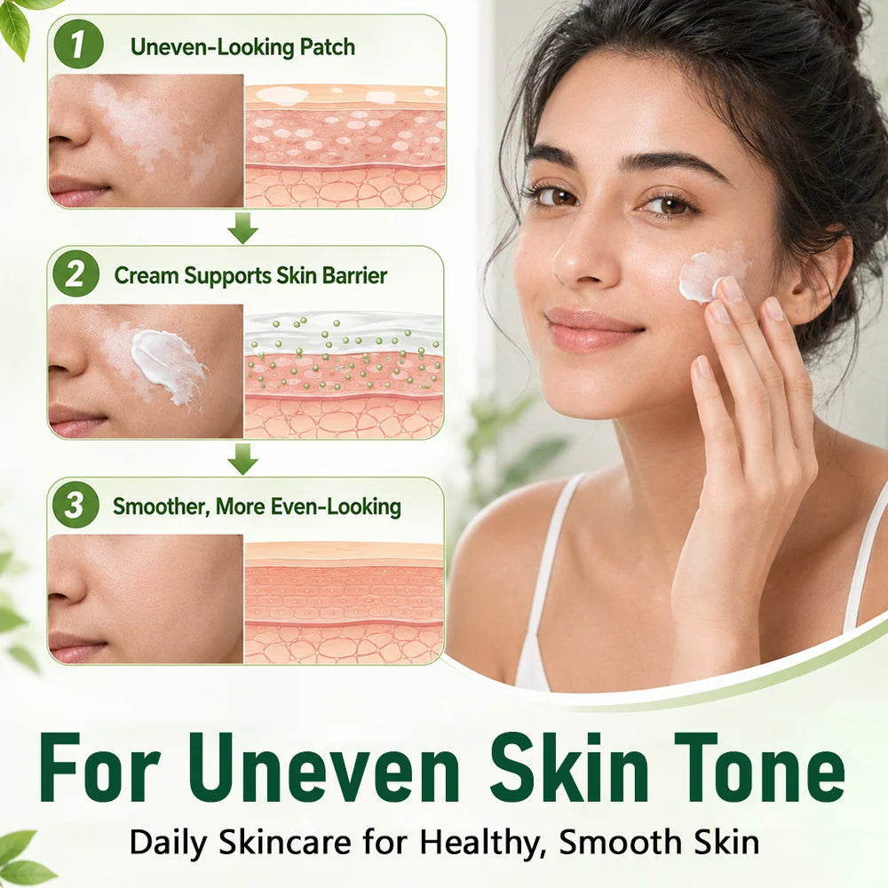 Herbal Vitiligo Cream