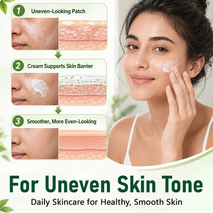 Herbal Vitiligo Cream