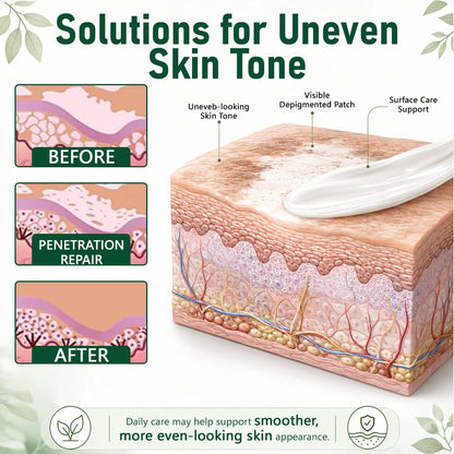 Herbal Vitiligo Cream